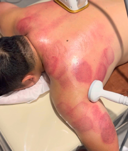 셀루리온 고주파관리